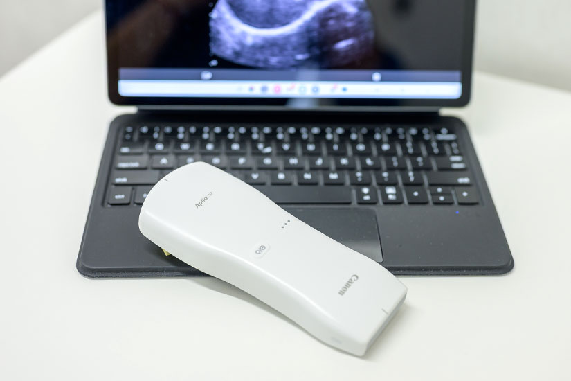 超音波装置（頚部、腹部）